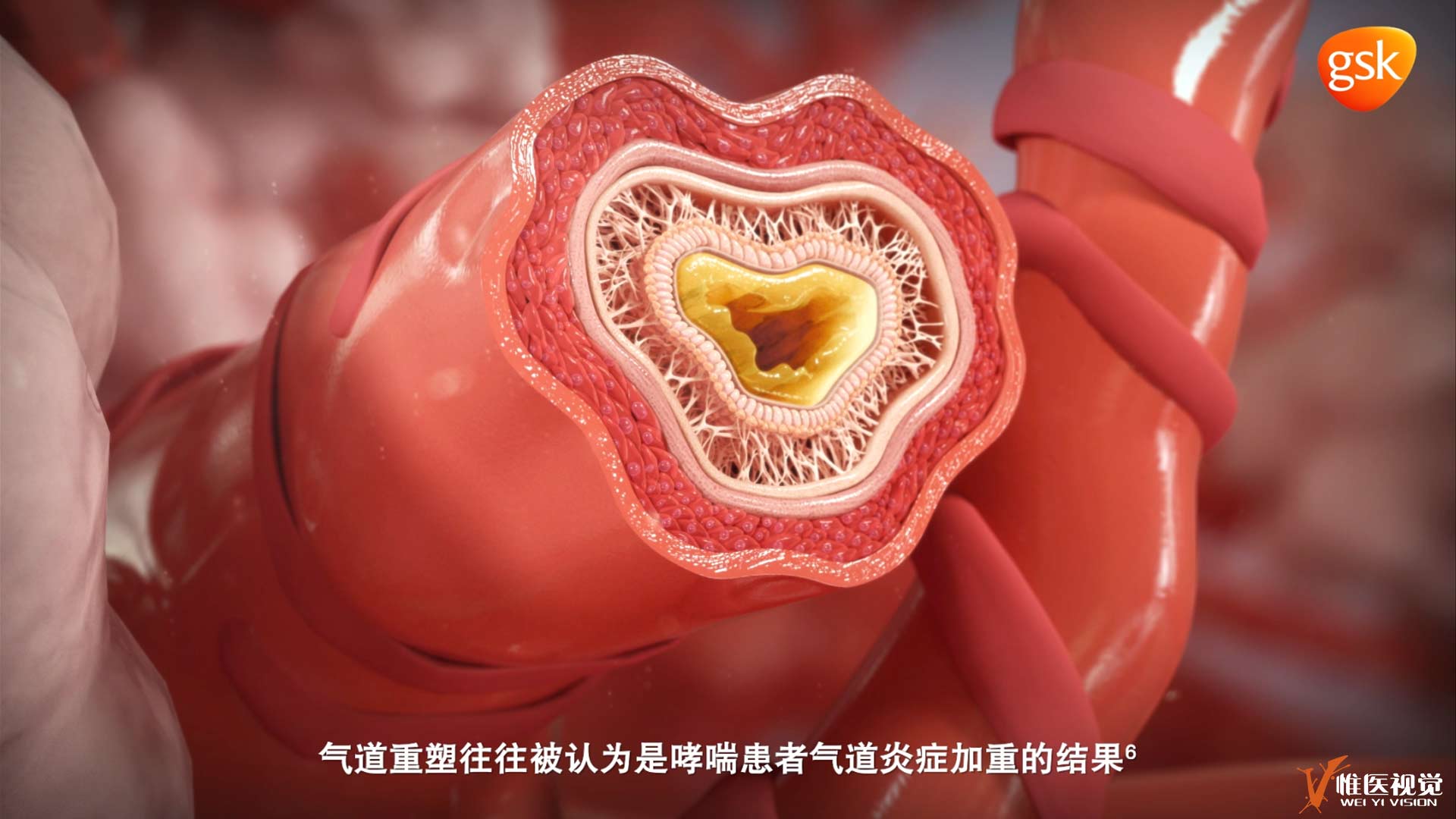 gsk4.jpg